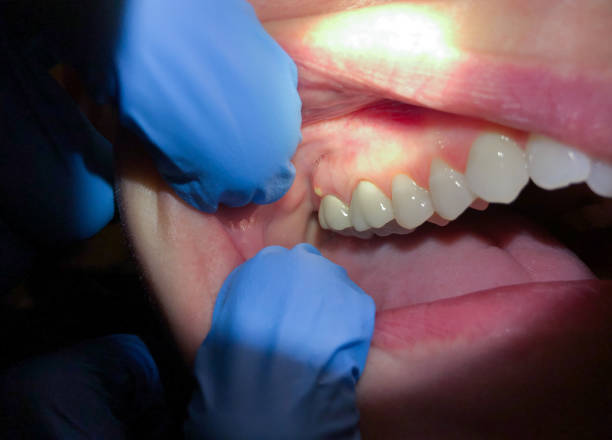 Best Knocked-Out Tooth Emergency  in Princeton Junction, NJ